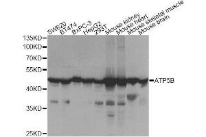 Western blot analysis of extracts of various cell lines, using ATP5B Antibody. (ATP5B anticorps  (AA 230-529))