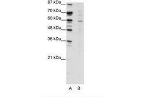 Image no. 1 for anti-Core-binding Factor, Runt Domain, alpha Subunit 2, Translocated To, 3 (CBFA2T3) (N-Term) antibody (ABIN203203) (CBFA2T3 anticorps  (N-Term))