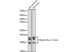 Western blot analysis of extracts of various cell lines, using Myelin Basic Protein antibody (ABIN3022348, ABIN3022349, ABIN3022350 and ABIN6218754) at 1:1000 dilution. (MBP anticorps  (AA 1-197))