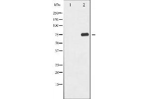 Western blot analysis of NF kappaB p65 phosphorylation expression in TNF-α treated COS7 whole cell lysates,The lane on the left is treated with the antigen-specific peptide.