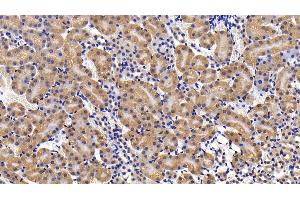 Detection of IL11Ra in Mouse Kidney Tissue using Polyclonal Antibody to Interleukin 11 Receptor Alpha (IL11Ra) (IL11RA anticorps  (AA 194-329))