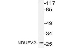 Western blot (WB) analysis of NDUFV2 antibody in extracts from Jurkat cells. (NDUFV2 anticorps)