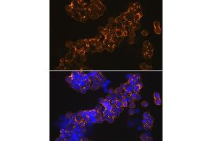 Immunofluorescence analysis of MCF-7 cells using NMD Rabbit mAb (ABIN7267417) at dilution of 1:100 (40x lens). (GRIN1/NMDAR1 anticorps)