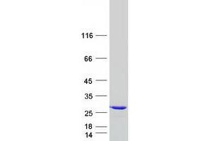 Validation with Western Blot