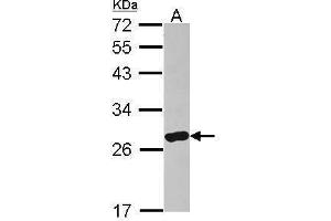 WB Image Sample (30 ug of whole cell lysate) A: IMR32 12% SDS PAGE antibody diluted at 1:500 (ARHGDIA anticorps)