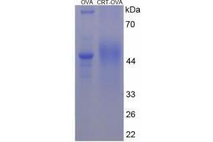 Image no. 1 for Calreticulin (CALR) peptide (Ovalbumin) (ABIN5666115) (Calreticulin (CALR) peptide (Ovalbumin))