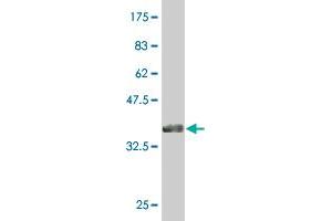 Western Blot detection against Immunogen (36. (CAND1 anticorps  (AA 1-100))