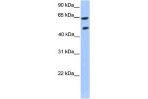 Western Blotting (WB) image for anti-Zinc Finger Protein 449 (ZNF449) antibody (ABIN2460260) (ZNF449 anticorps)