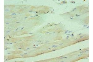 Immunohistochemistry of paraffin-embedded human skeletal muscle tissue using ABIN7148336 at dilution of 1:100 (C1QB anticorps  (AA 104-253))