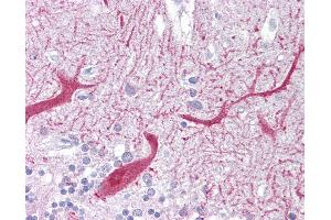 Anti-PON1 antibody IHC of human brain, cerebellum. (PON1 anticorps  (AA 215-264))