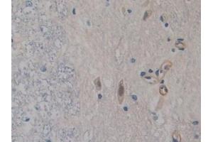 Detection of FABP9 in Rat Spinal cord Tissue using Polyclonal Antibody to Fatty Acid Binding Protein 9, Testis (FABP9) (FABP9 anticorps  (AA 1-130))