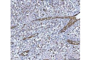 IHC analysis of PTRF/CAVIN1 using anti-PTRF/CAVIN1 antibody (ABIN7601817). (PTRF anticorps  (AA 47-390))