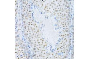 Immunohistochemistry of paraffin-embedded mouse testis using MAPK3 Antibody.
