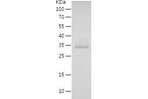 Western Blotting (WB) image for Filamin Binding LIM Protein 1 (FBLIM1) (AA 1-200) protein (His tag) (ABIN7122967)