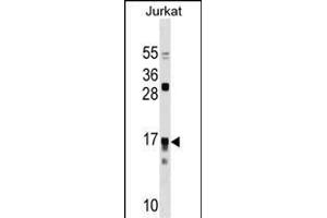IL17RC Antibody (N-term) (ABIN1538937 and ABIN2850039) western blot analysis in Jurkat cell line lysates (35 μg/lane). (IL17RC anticorps  (N-Term))