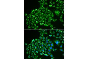 Immunofluorescence analysis of MCF-7 cells using RCVRN antibody. (Recoverin anticorps)