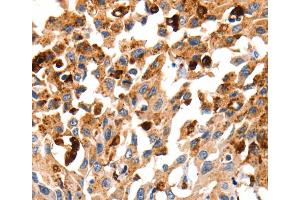 Immunohistochemistry (IHC) image for anti-Cathepsin B (CTSB) antibody (ABIN2427898) (Cathepsin B anticorps)