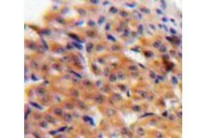 IHC-P analysis of Ovary tissue, with DAB staining. (CCL27 anticorps  (AA 25-112))