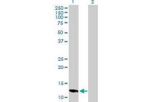 Western Blot analysis of LOC494141 expression in transfected 293T cell line by LOC494141 MaxPab polyclonal antibody. (SLC25A51P4 anticorps  (AA 1-154))