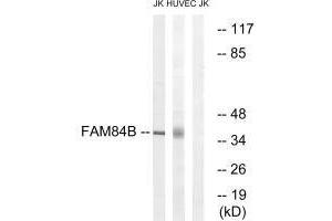Western blot analysis of extracts from Jurkat cells and HUVEC cells, using FAM84B antibody. (FAM84B anticorps  (N-Term))