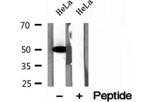 Western blot analysis of extracts of HeLa cells, using GLUD1 antibody. (GLUD1 anticorps  (Internal Region))
