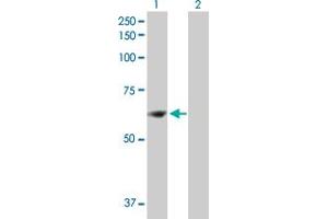 Western Blot analysis of ZNF599 expression in transfected 293T cell line by ZNF599 MaxPab polyclonal antibody. (ZNF599 anticorps  (AA 1-588))