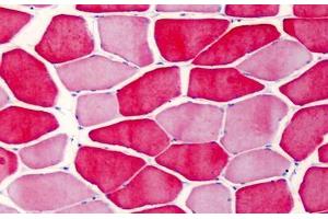 Human Skeletal Muscle: Formalin-Fixed, Paraffin-Embedded (FFPE) (TNNI2 anticorps)