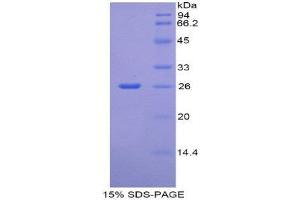 SDS-PAGE (SDS) image for CREB Binding Protein (CREBBP) (AA 2216-2442) protein (His tag) (ABIN1877592)