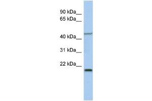 WB Suggested Anti-KLF15 Antibody Titration:  0. (KLF15 anticorps  (Middle Region))