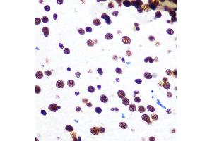 Immunohistochemistry of paraffin-embedded mouse brain using SFPQ Rabbit mAb (ABIN7270547) at dilution of 1:100 (40x lens).