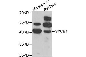 Western blot analysis of extracts of mouse liver and rat liver cell lines, using SYCE1 antibody. (SYCE1 anticorps)