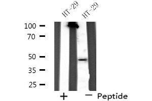 Western blot analysis of extracts from HT-29 cells, using SERPINA11 antibody.
