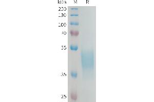 Human DL3 Protein, His Tag on SDS-PAGE under reducing condition.