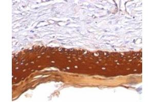 Immunohistochemical staining (Formalin-fixed paraffin-embedded sections) analysis of human skin with Pan Cytokeratin monoclonal antibody, clone AE1 + AE3  at 1:200 using peroxidase-conjugate and DAB chromogen. (Keratin 77 anticorps)