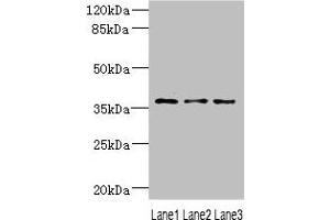 Western blot All lanes: DNAJB2 antibody at 1. (DNAJB2 anticorps  (AA 215-324))