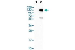 Western blot analysis of Lane 1: Negative control (vector only transfected HEK293T lysate) and Lane 2: Over-expression lysate (Co-expressed with a C-terminal myc-DDK tag (~3. (TAO Kinase 3 anticorps  (AA 323-432))