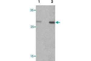 Western blot analysis of rat spleen tissue lysate with CLEC7A polyclonal antibody  at (1) 1 and (2) 2 ug/mL. (CLEC7A anticorps  (Internal Region))