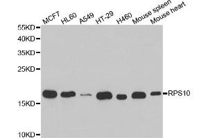 Western Blotting (WB) image for anti-Ribosomal Protein S10 (RPS10) antibody (ABIN1980247) (RPS10 anticorps)