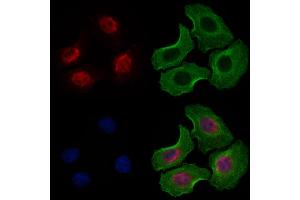 ABIN6263656 and ABIN6277487 staining Hela cells by IF/ICC. (Nemo-Like Kinase anticorps  (N-Term))
