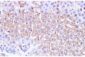 Immunohistochemistry of paraffin-embedded Mouse liver using GCK Polyclonal Antibody at dilution of 1:100 (GCK anticorps)