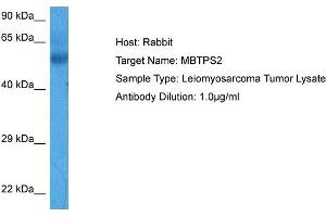 Host:  Rabbit  Target Name:  MBTPS2  Sample Tissue:  Human Leiomyosarcoma Tumor lysates  Antibody Dilution:  1ug/ml (MBTPS2 anticorps  (N-Term))