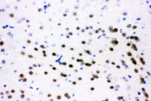 IHC analysis of ATF2 using anti-ATF2 antibody .