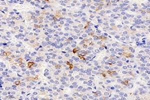 Immunohistochemistry analysis of paraffin-embedded rat pituitary using,CHST8 (ABIN7073301) at dilution of 1: 3000 (CHST8 anticorps)