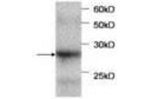 Image no. 1 for anti-serpin Peptidase Inhibitor, Clade B (Ovalbumin), Member 4 (SERPINB4) antibody (ABIN791514) (SERPINB4 anticorps)