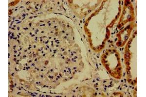 Immunohistochemistry of paraffin-embedded human kidney tissue using ABIN7148855 at dilution of 1:100 (CDK13 anticorps  (AA 1-170))