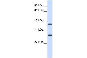 FAM156A antibody used at 1 ug/ml to detect target protein. (FAM156A anticorps  (N-Term))