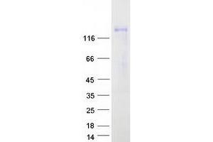 Validation with Western Blot