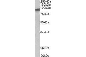 Western Blotting (WB) image for anti-Zinc Finger Protein 652 (ZNF652) (C-Term) antibody (ABIN2464976) (ZNF652 anticorps  (C-Term))
