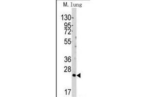 Western blot analysis of anti-hBid-BH3 Pab (ABIN388099 and ABIN2846183) in mouse lung tissue lysates (35 μg/lane). (BID anticorps  (AA 68-103))
