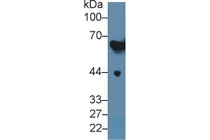 Detection of CK2 in Rat Serum using Polyclonal Antibody to Keratin 2 (CK2)